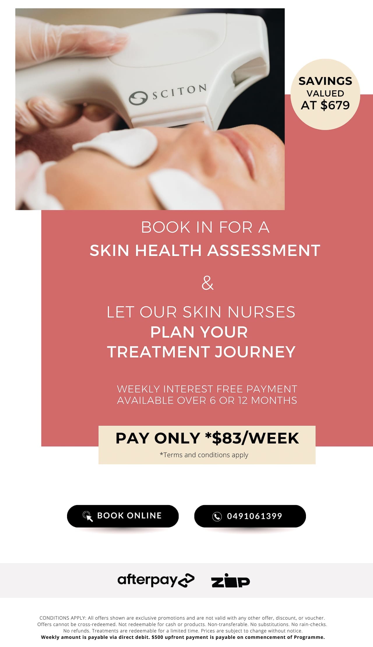 Acne promo treatment April 2023 The Skin Nurse Perth Australia