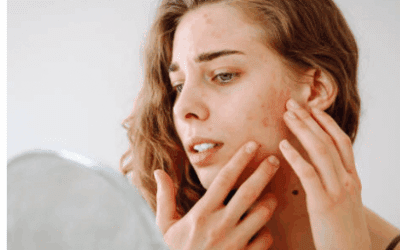 How to Treat Pigmentation Safely: Expert Skin Consultations & Products in Perth