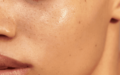 Best Pigmentation, Ageing, and Acne Skincare Products